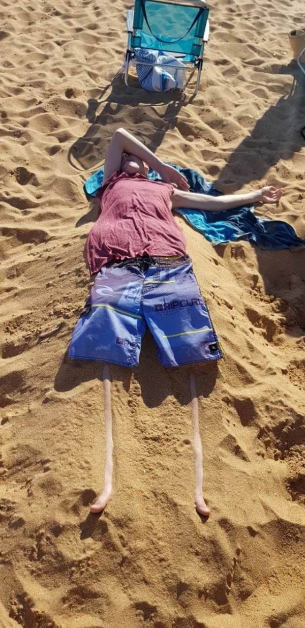 silly pictures of skinny legs buried in sand
